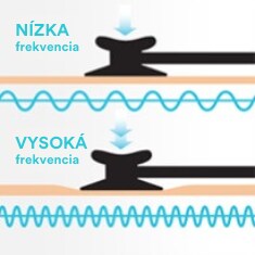 Na hornom nákrese je znázornený jemný prítlak na nastaviteľnú membránu, ktorým sa prenášajú nízkofrekvenčné zvuky, na dolnom nákrese je znázornený silnejší tlak na prenos vysokofrekvenčných zvukov.